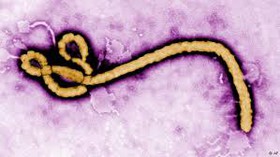 Image result for بیماری ابولا